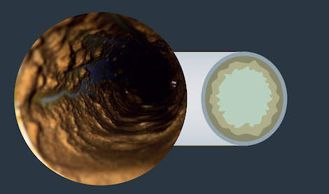 Biofilm in drinkwaterleiding